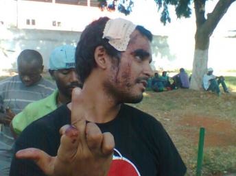 Angolan Rapper Luaty Beirão’s Hunger Strike Hits Day 26