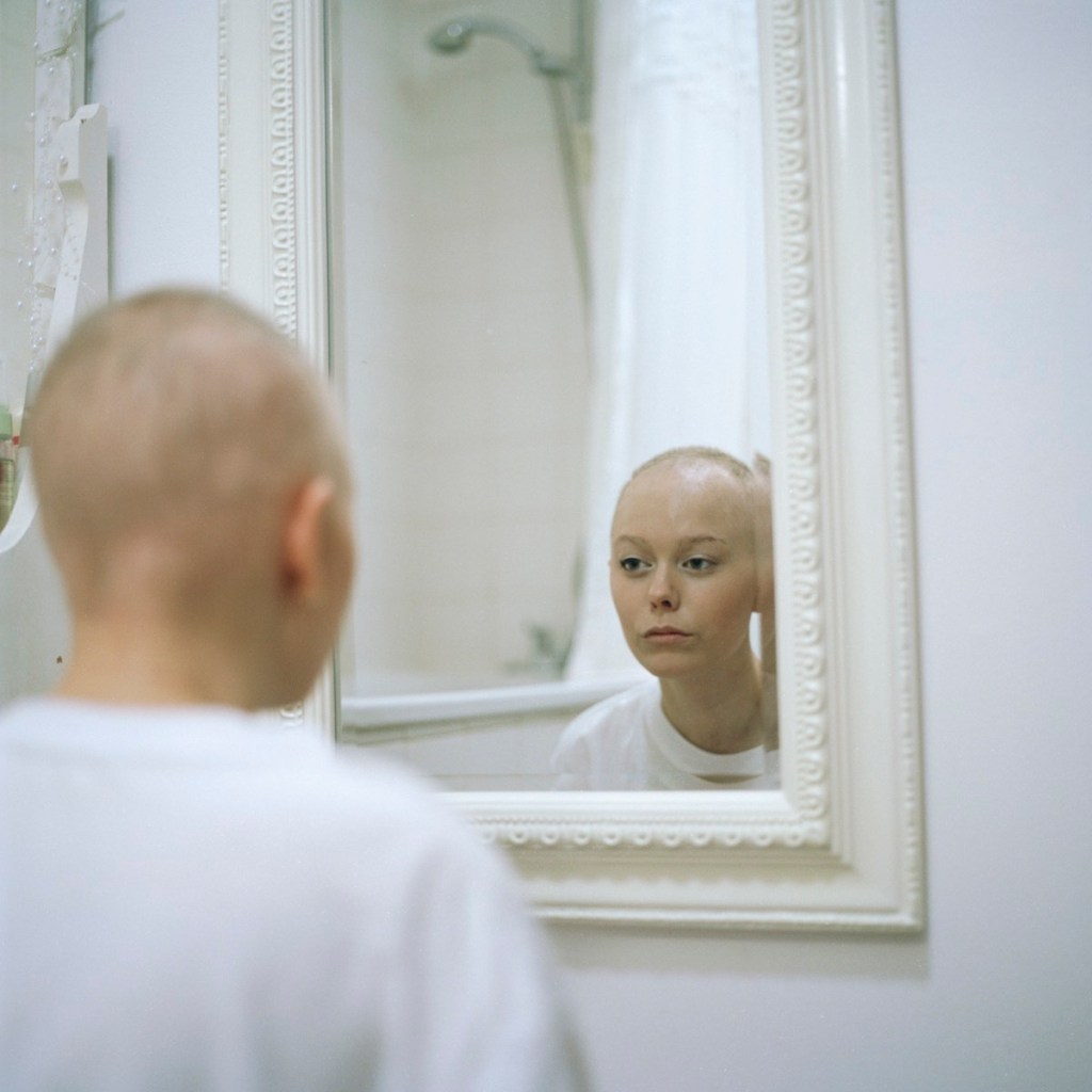 Как меняется жизнь, когда ваша 20-летняя девушка заболевает раком: фотографии
