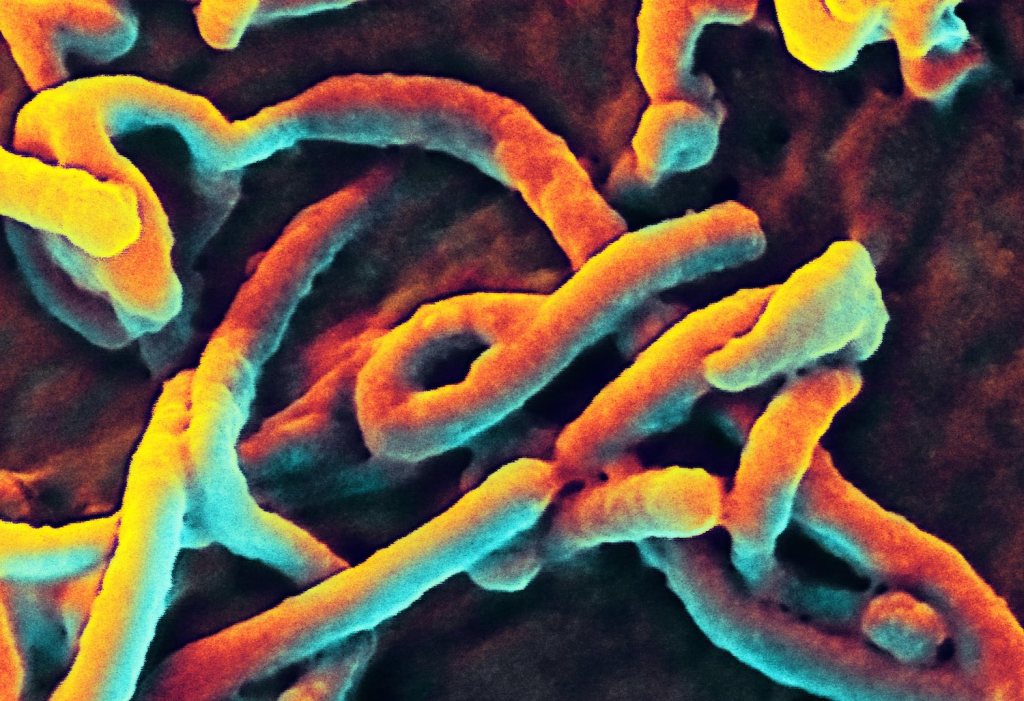 The World Is Unprepared for the Next Big Virus Outbreak, Study Finds