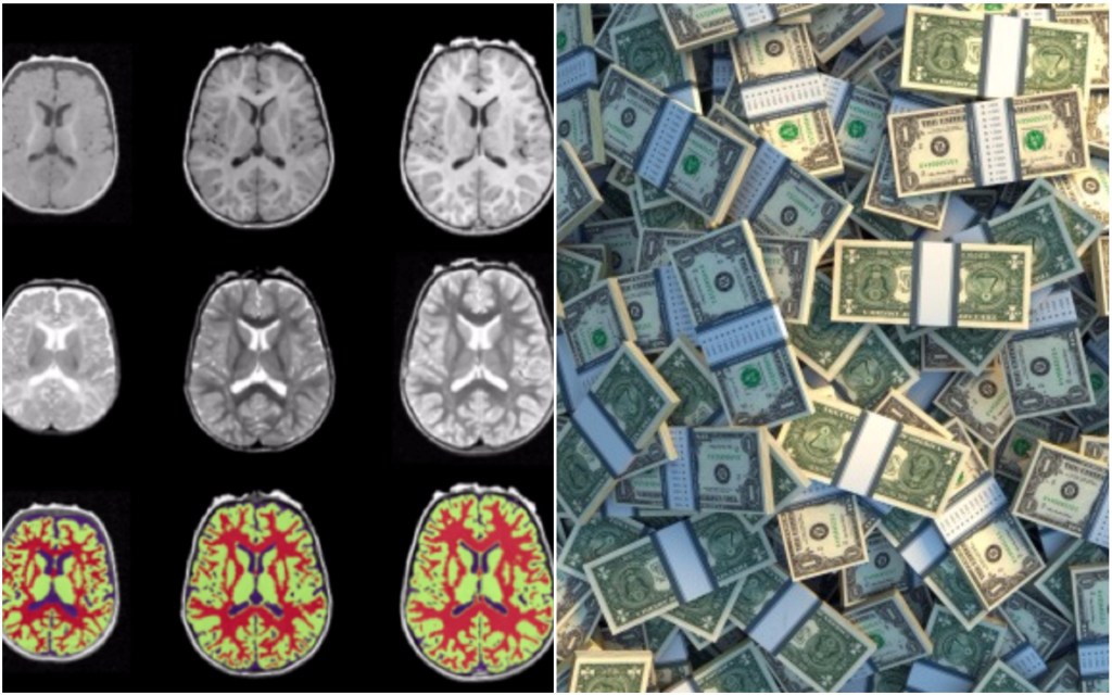The Science of How Poverty Harms the Brain