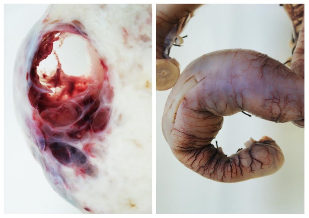 Photographing Victorian Corpses Exposes the Beauty of the Human Body