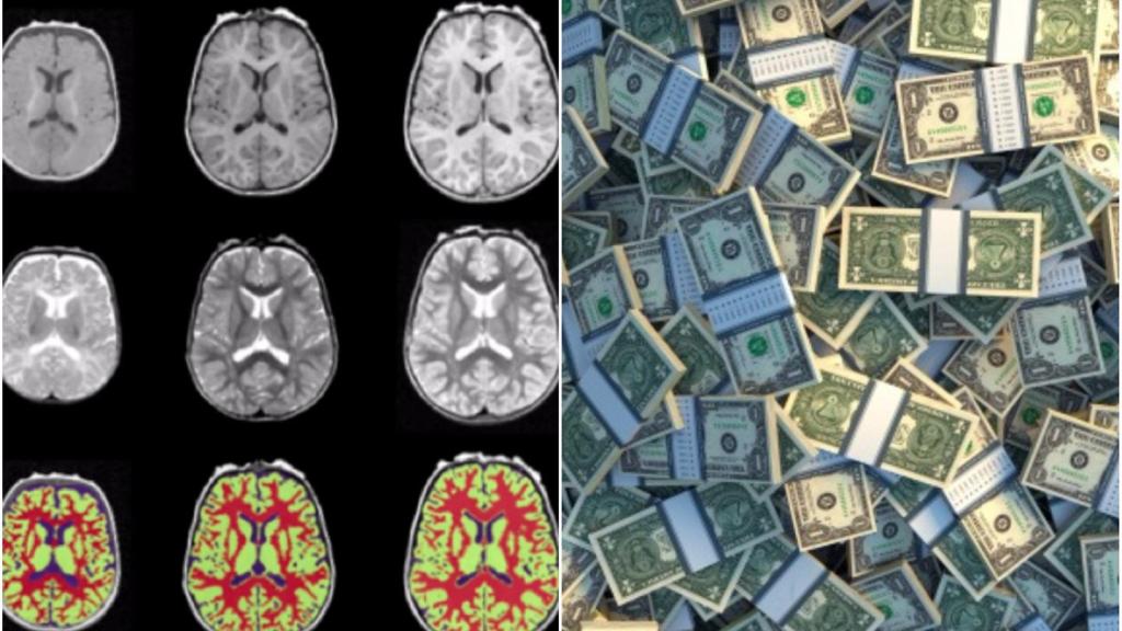 The Science of How Poverty Harms the Brain