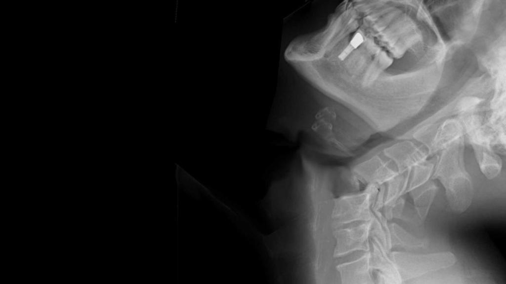 Cómo lesionar a alguien brutalmente