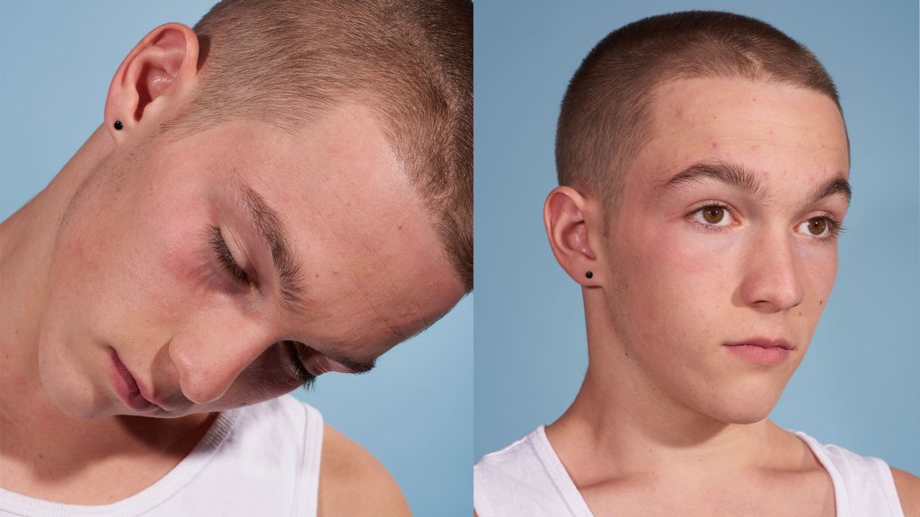 We’re Taking the First Steps Toward a Cure for Narcolepsy