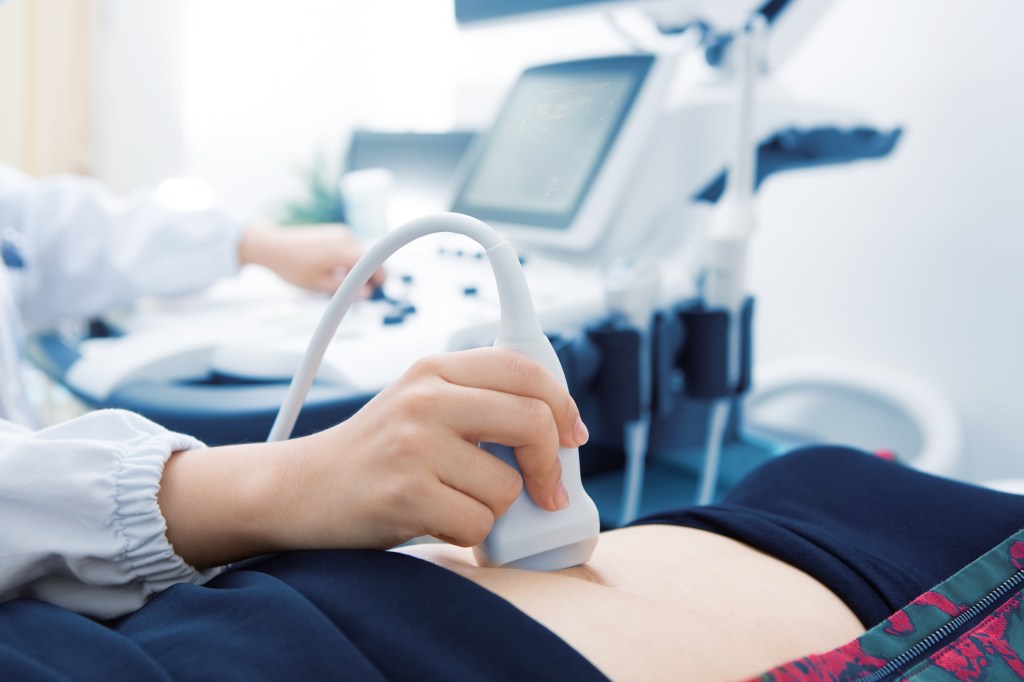 Ohio Senate Passes Bill to Ban Abortions in Cases of Down Syndrome [Updated]