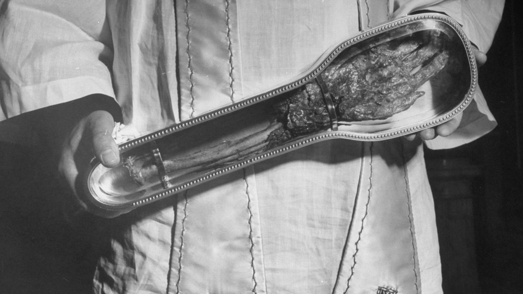 There’s a Severed Arm Touring Canada And It’s Metal As Hell