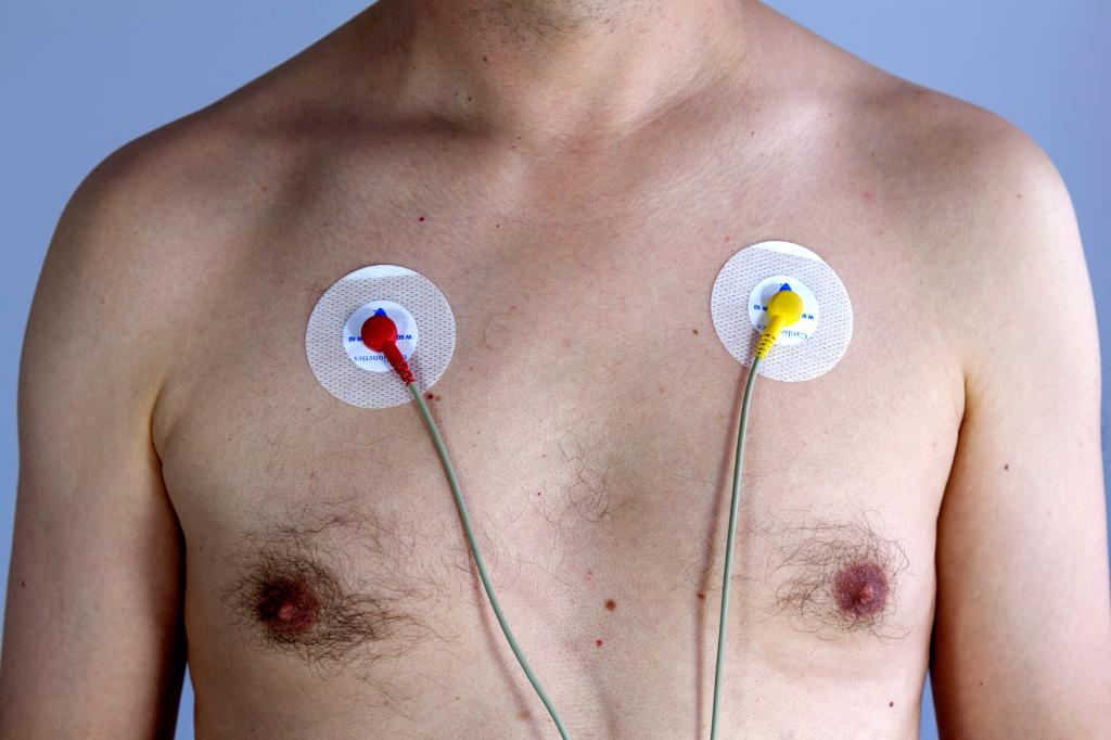 Why You Might Suddenly Die in Your Twenties