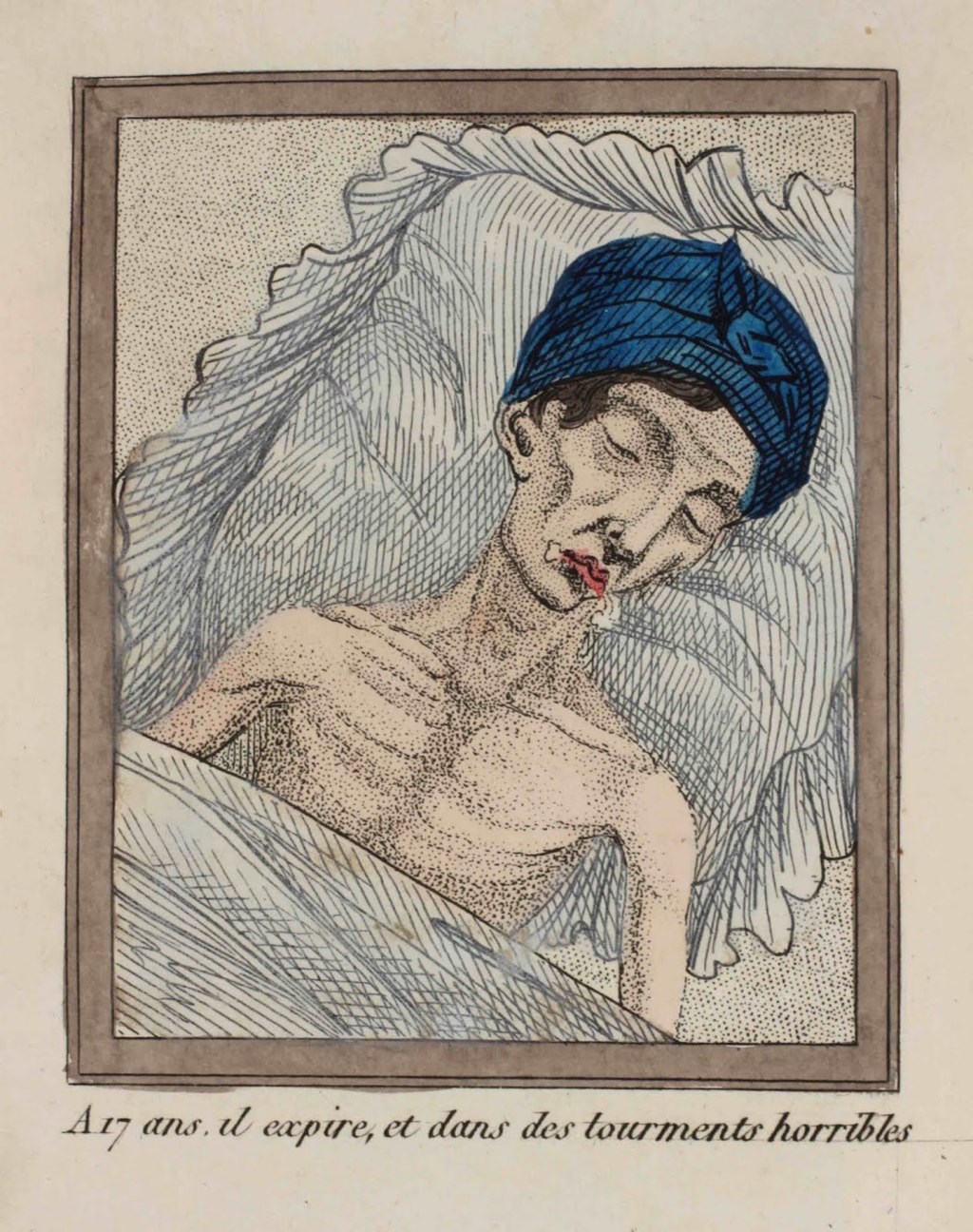 Des dangers mortels de la masturbation