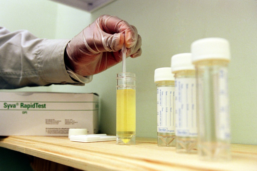 What Happens if You Refuse to Take a Drug Test for Work?
