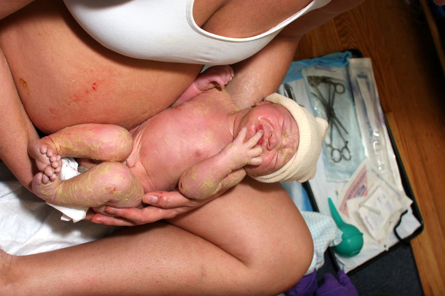 People Who Want Home Births Have to Jump Through All Kinds of Hoops