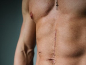 Survivre à une attaque au couteau a foutu ma vie en l'air