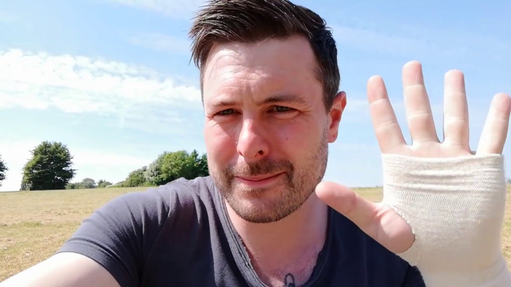 Dieser YouTuber hat seinen Krebstod gevloggt – und zeigt, wie man mutig lebt