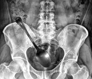 x-ray-spoon