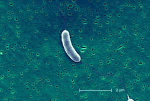 Vibrio Vulnificus.