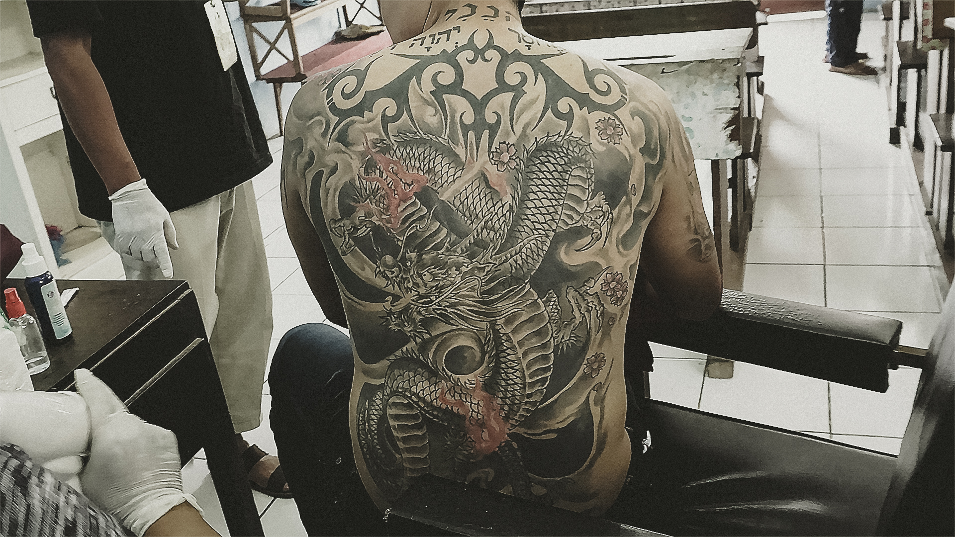 1558945104215-Tattoo-Removal-9-of-9