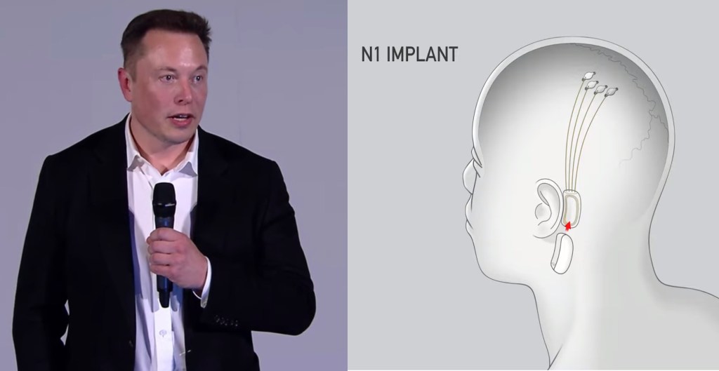 Elon Musk ha annunciato un piano per ‘fondere’ il cervello umano con l’intelligenza artificiale