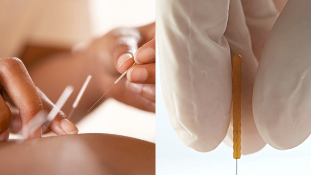Schoolboy Inserts Acupuncture Needle Into His Genitals to Stay Awake