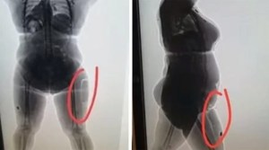 Mujer cocaína pierna españa