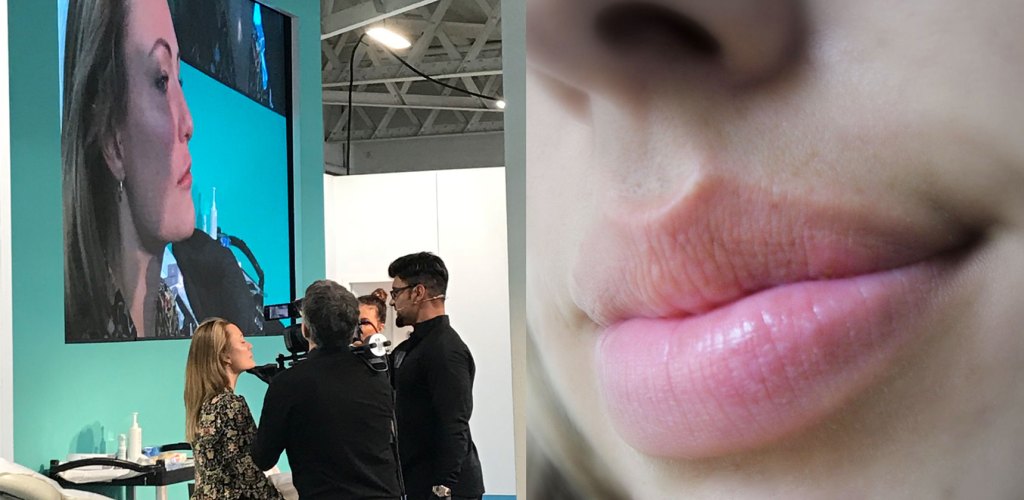 lip fillers cosmetic non-surgical procedures trends 2020