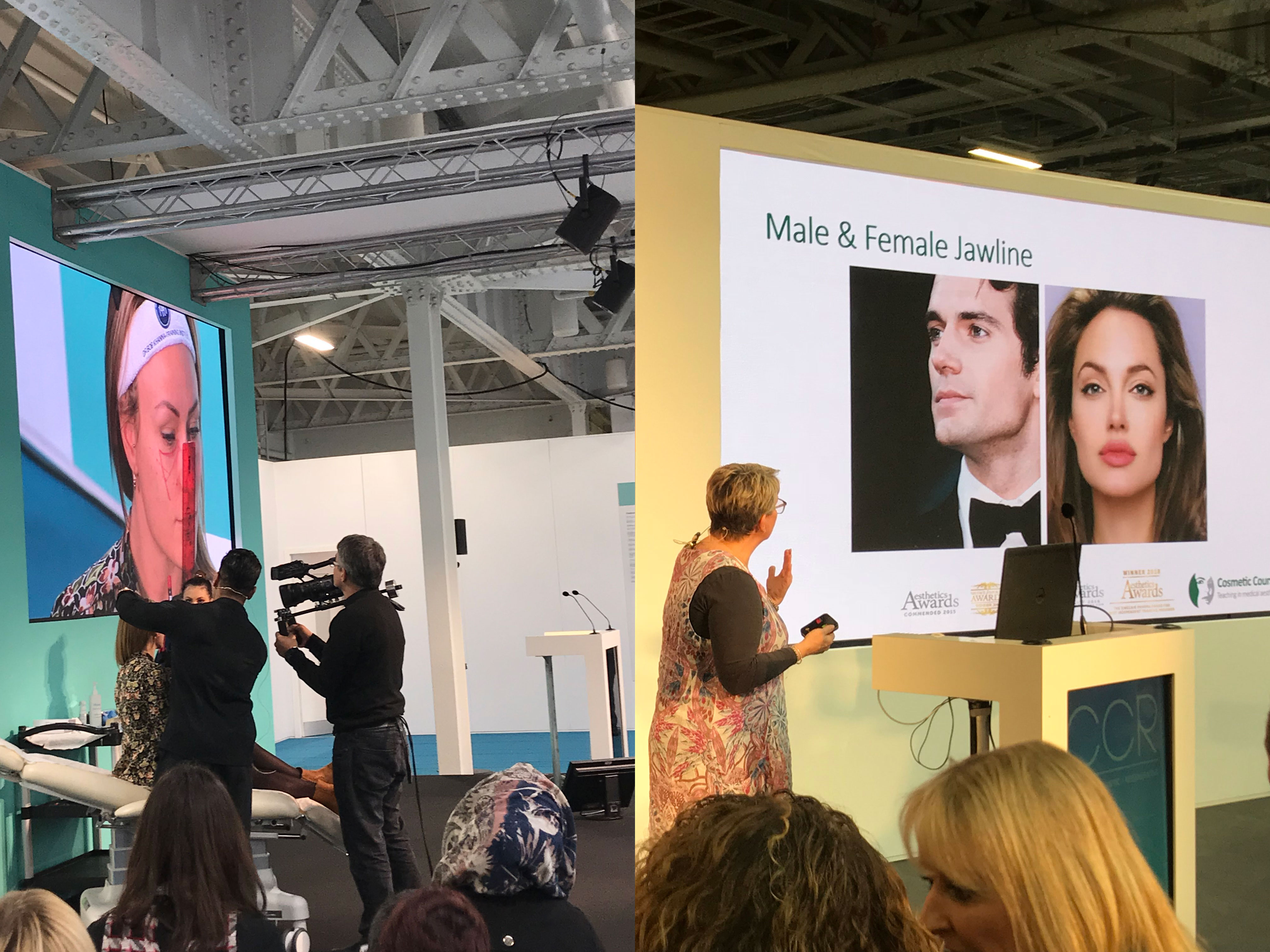 lip fillers expo face filler future trends