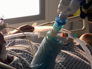 Patient intubé en réanimation