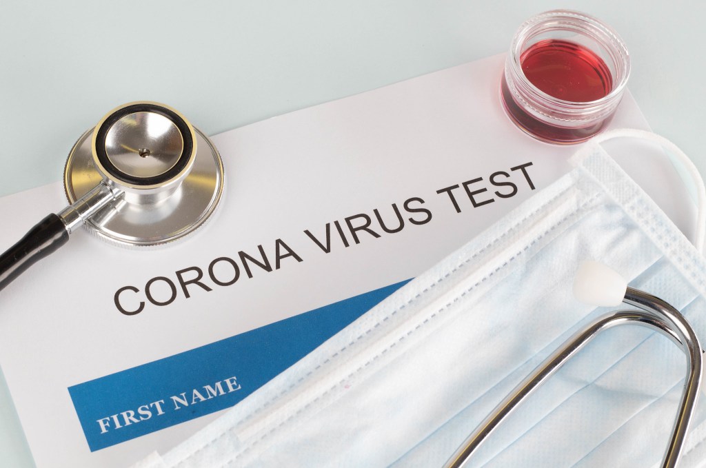 U Srbiji je nemoguće testirati se na korona virus van državnih laboratorija. Zašto?