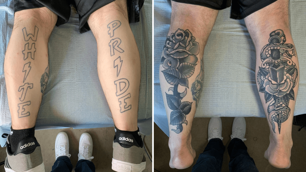 Van hakenkruis naar bloem: deze mensen lieten hun racistische tattoos wegwerken