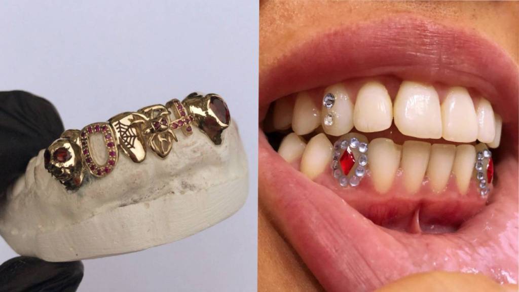 Τα Grills και τα Κοσμήματα Δοντιών Είναι η Επόμενη Παρορμητική Αγορά σου