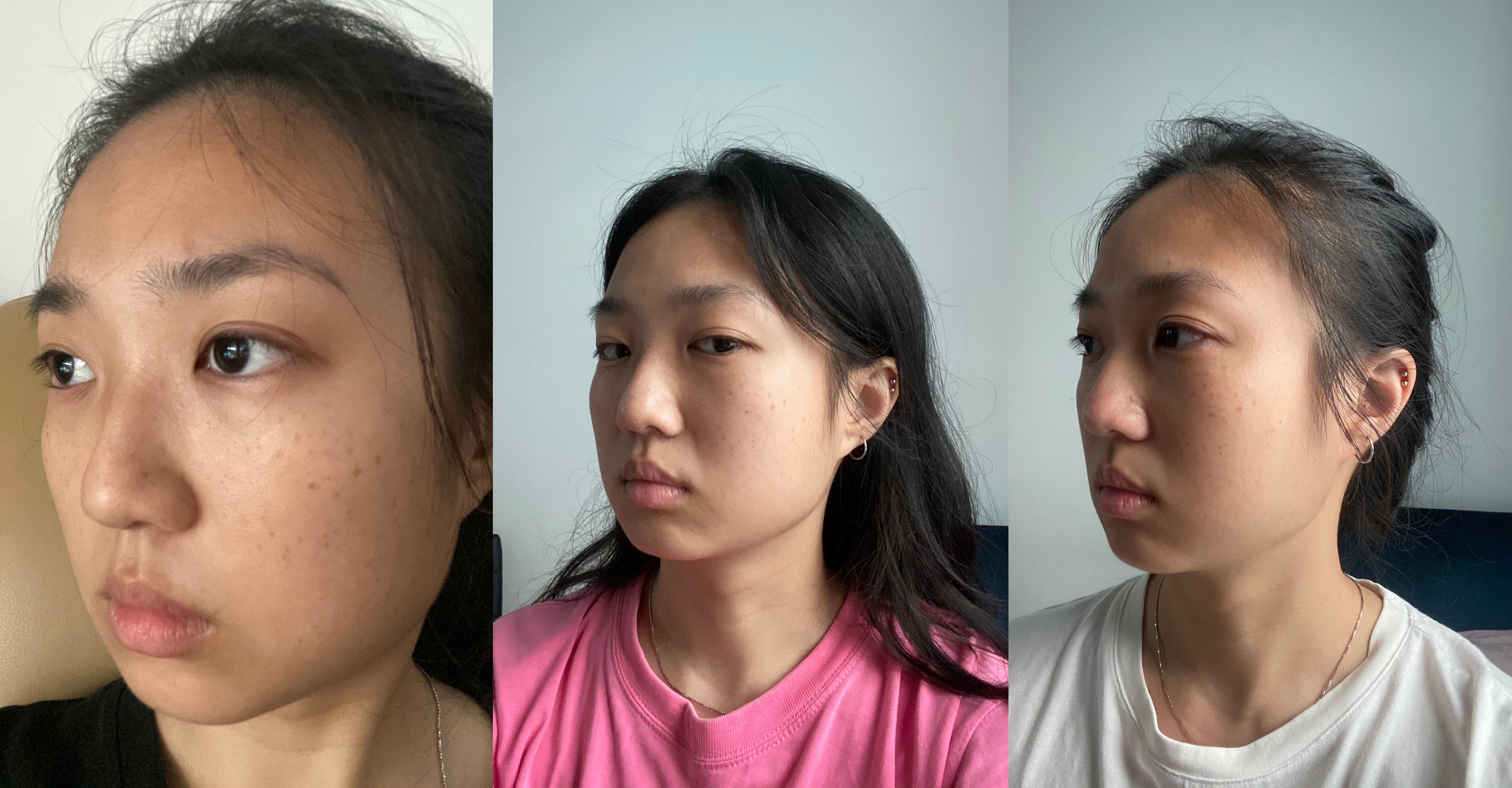 rezultate gua sha