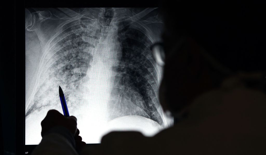 AI Can Guess Your Race Based On X-Rays, and Researchers Don’t Know How