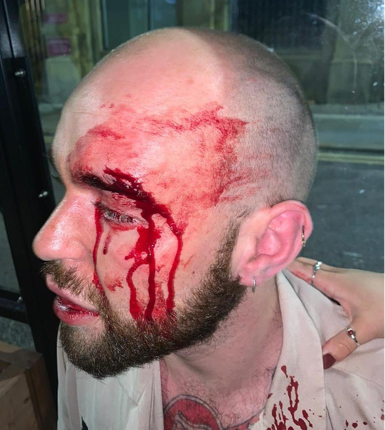 aj hate crime lgbtq.jpg