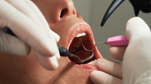 stomatolog sex oral dentist medicina sanatate