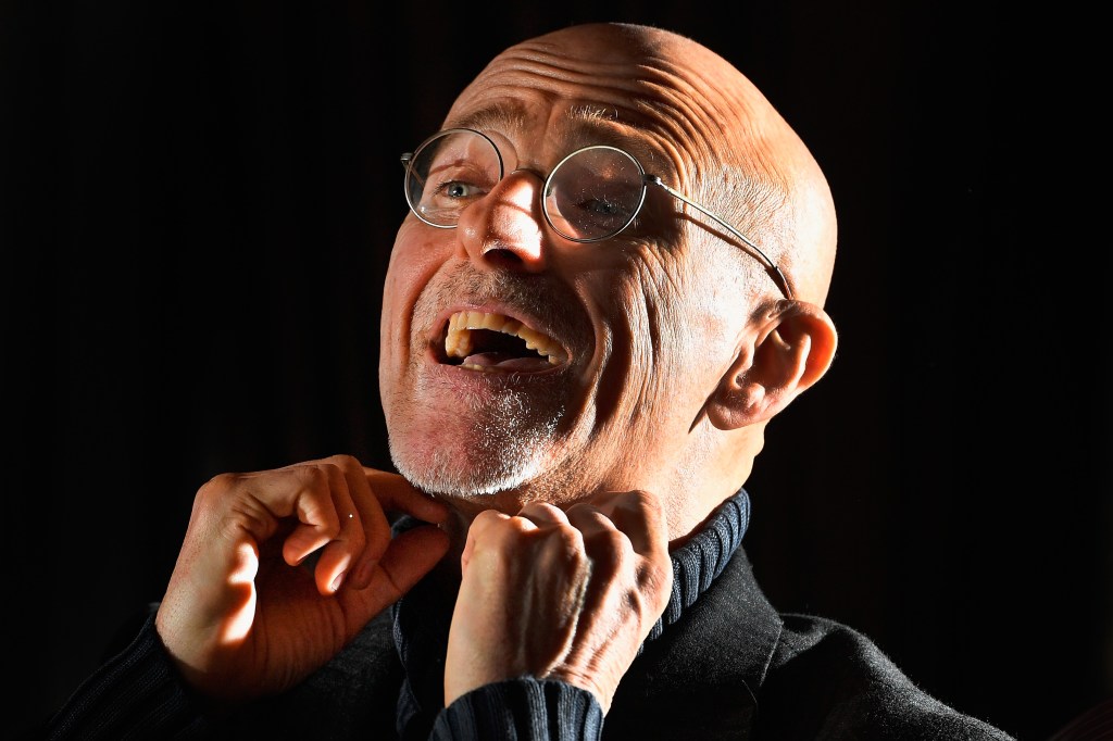 Head Transplant Surgeon Claims Human Brain Transplants Are ‘Technically Feasible’
