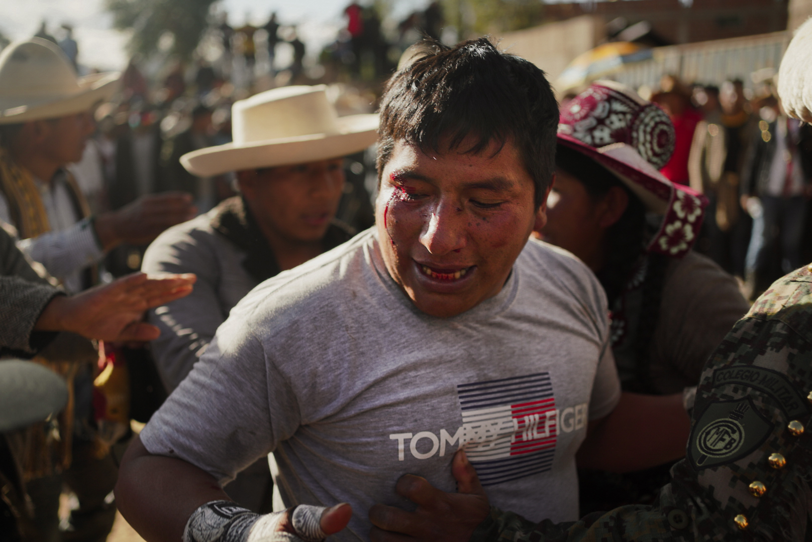 Takanakuy, Peru – photo os a middle-aged man wearing a grey t-shirt and bleeding from his eyebrow and mouth. A group of people around him are helping him.