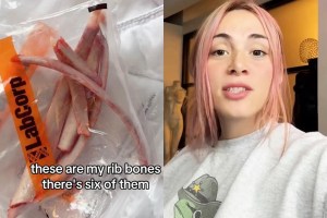 influencer-who-had-ribs-removed-plans-to-turn-them-into-a-crown