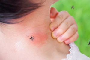 mosquito biting child